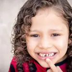 Caduta denti da latte: ordine, tempi e cosa fare