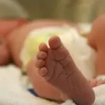 Aumento delle nascite premature