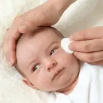 Consigli utili per calmare un eczema nel bambino