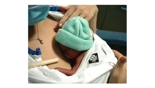 Marsupioterapia, il metodo della mamma canguro