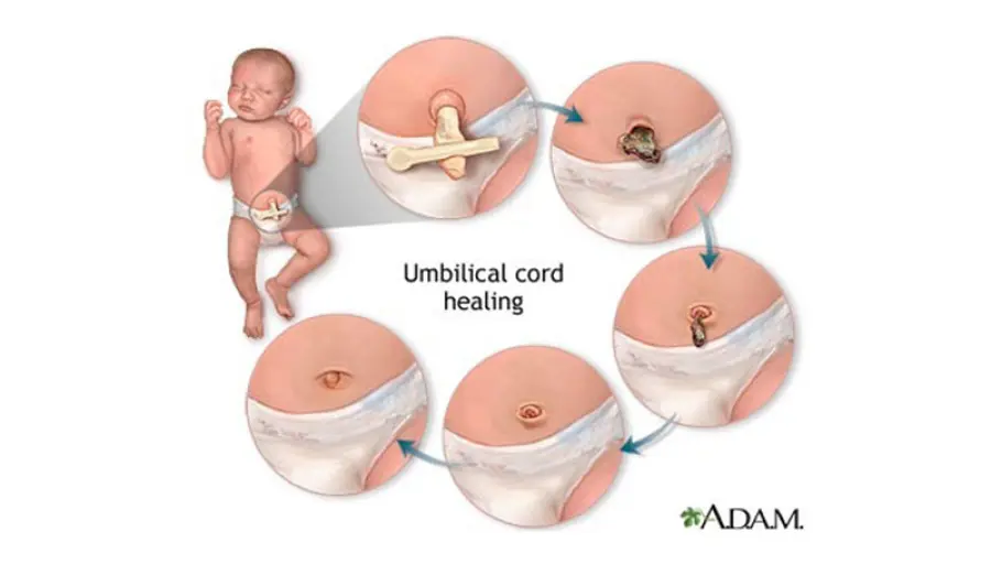 Cordone ombelicale: come pulirlo e medicarlo