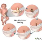 Cordone ombelicale: come pulirlo e medicarlo