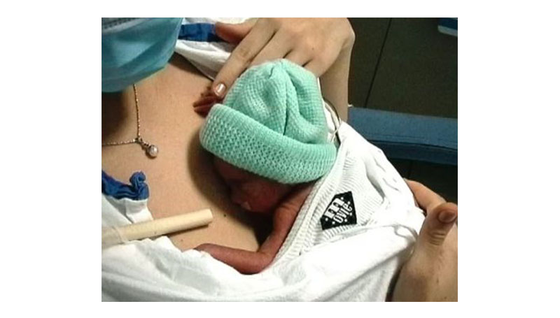 Marsupioterapia, il metodo della mamma canguro