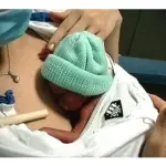 Marsupioterapia, il metodo della mamma canguro