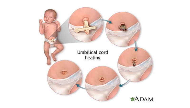 Cordone ombelicale: come pulirlo e medicarlo