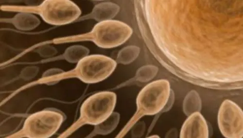 Variante genetica possibile causa dell'infertilità femminile