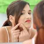 L’età dell’adolescenza…quanti problemi, uno di questi è l’acne