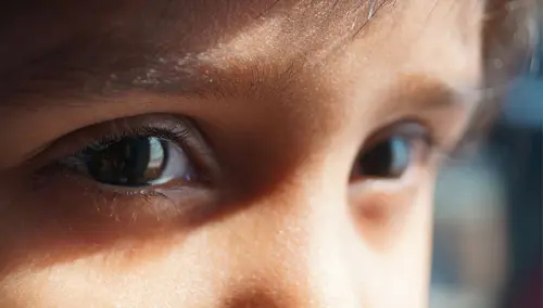 Cos’è l’autismo?