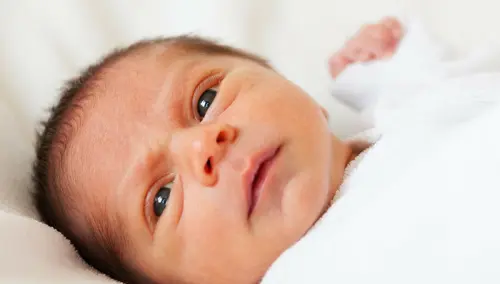 Ittero neonati: quando è patologico