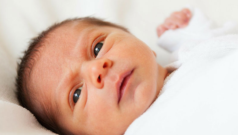 Ittero neonati: quando è patologico