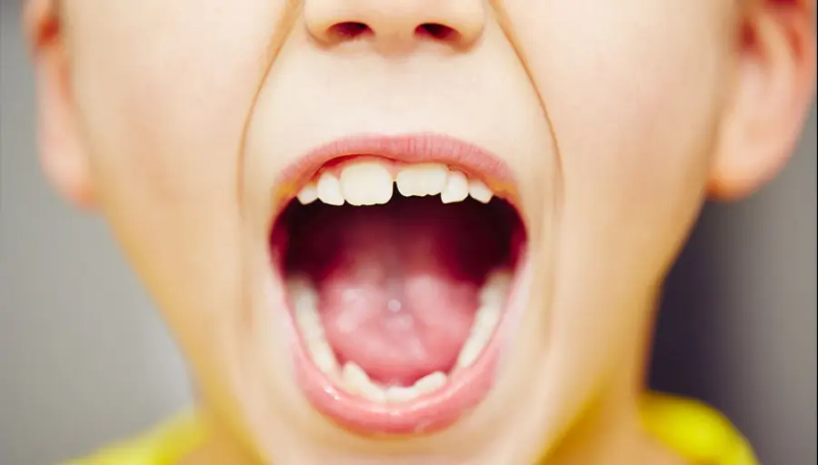 L'eruzione dentaria dei denti da latte