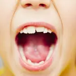 L'eruzione dentaria dei denti da latte