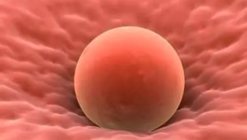 Rimane incinta grazie ad un autotrapianto di tessuto ovarico: la storia di Alessandra