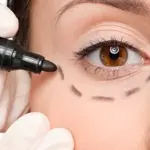 Chirurgia estetica non invasiva