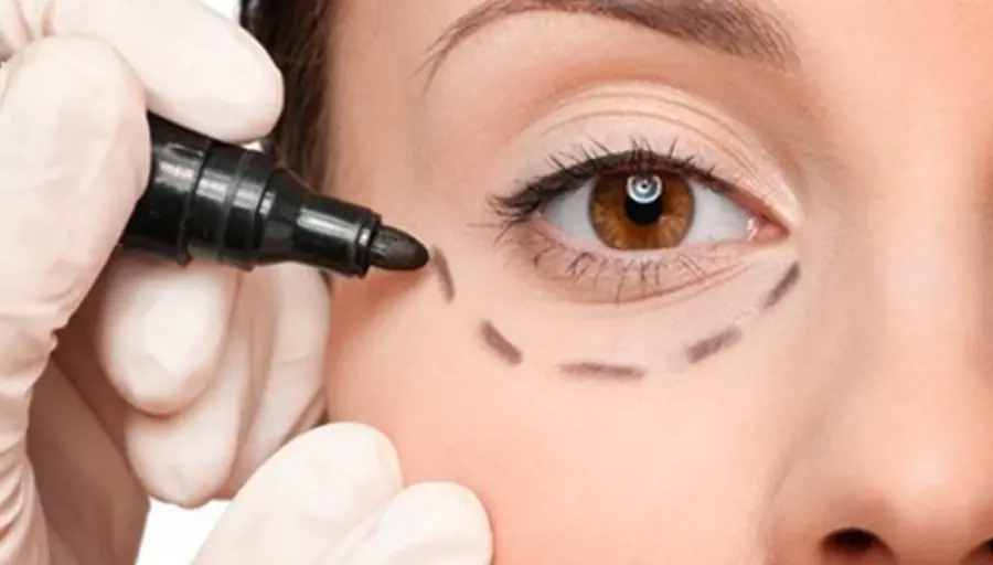 Chirurgia estetica non invasiva