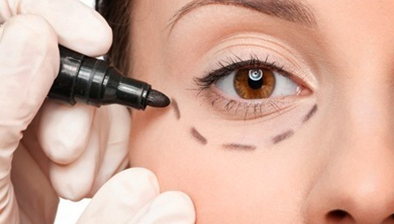 Chirurgia estetica non invasiva