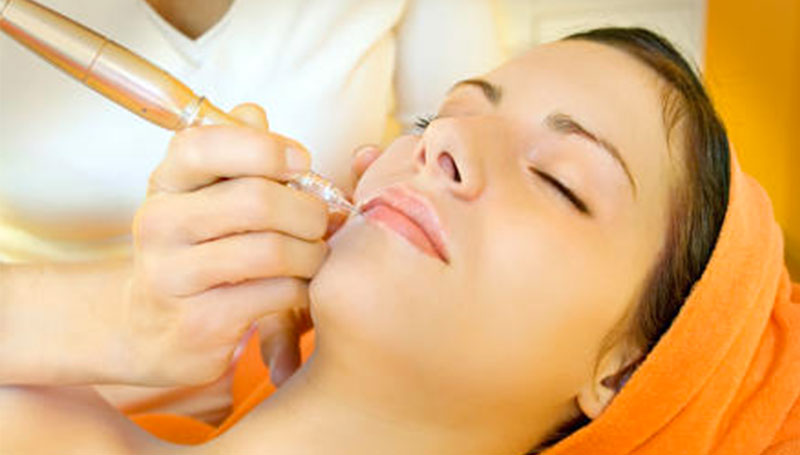 Un nuovo sistema di peeling personalizzato