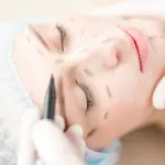 Di nuovo in forma con una liposuzione? meglio saperne di più