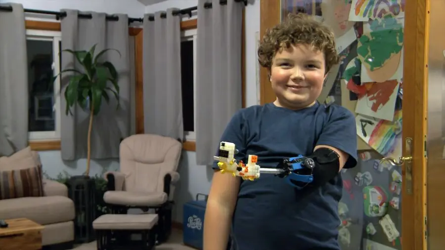 Protesi alla mano: il futuro per i bambini potrebbe essere la mano Lego progettata dal piccolo Aidan