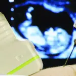 Diagnosi prenatale: l’amniocentesi