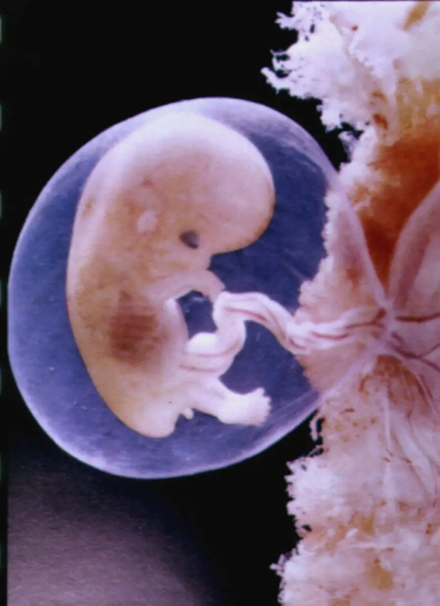 Gravidanza: amniocentesi addio?