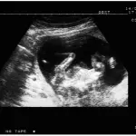 Diagnosi prenatale: invasiva e non invasiva