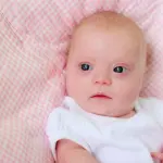 Sindrome di Down, l'importanta della transulecenza nucale