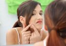 L’età dell’adolescenza…quanti problemi, uno di questi è l’acne