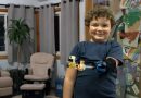 Protesi alla mano: il futuro per i bambini potrebbe essere la mano Lego progettata dal piccolo Aidan