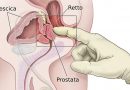 Problemi di prostata: come aiutare il mio compagno